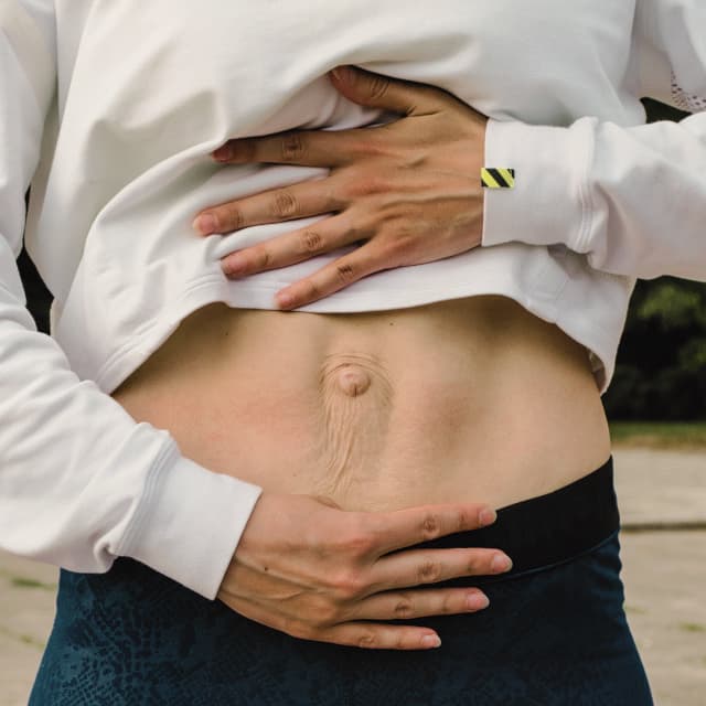Diastasis recti close-up showing abdominal separation