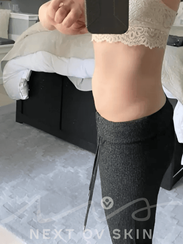 HIFU Body Sculpting in Edmonds, WA