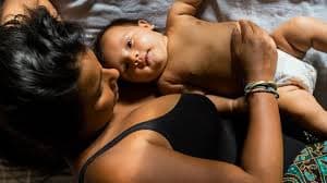 Comprehensive Care For C-Section Incision: Tips for New Moms